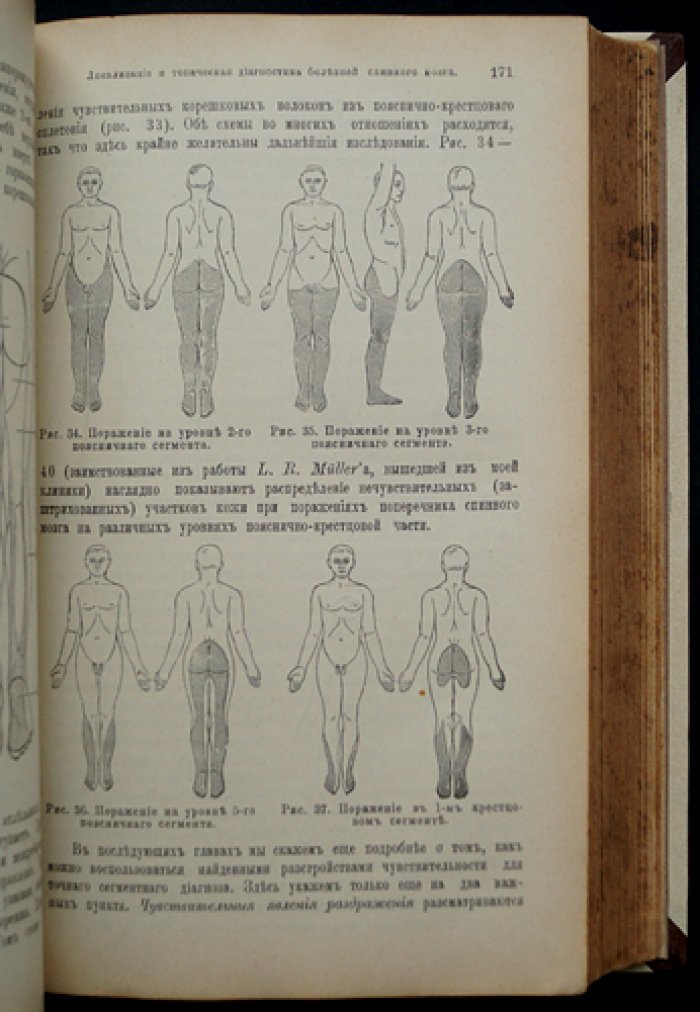 Учебник частной патологии и терапии внутренних болезней (в 3 томах) — Штрюмпель