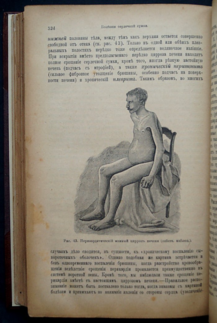 Учебник частной патологии и терапии внутренних болезней (в 3 томах) — Штрюмпель