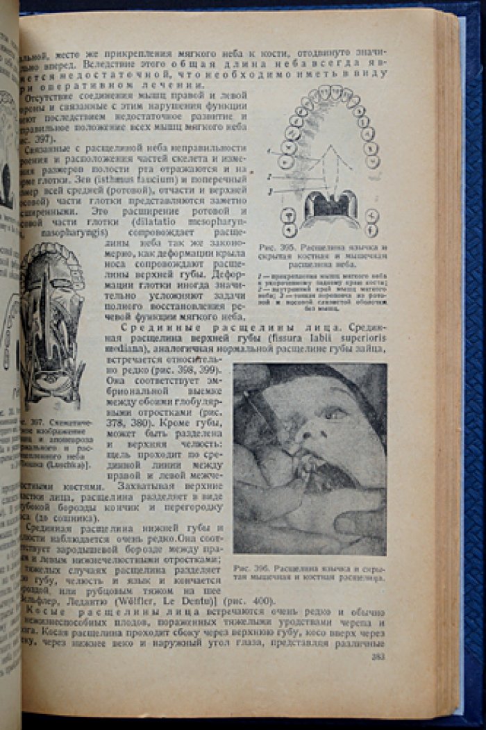 Учебник хирургической стоматологии (1938) — наркоз, экстракция, воспаления, травмы и врожденные патологии лица