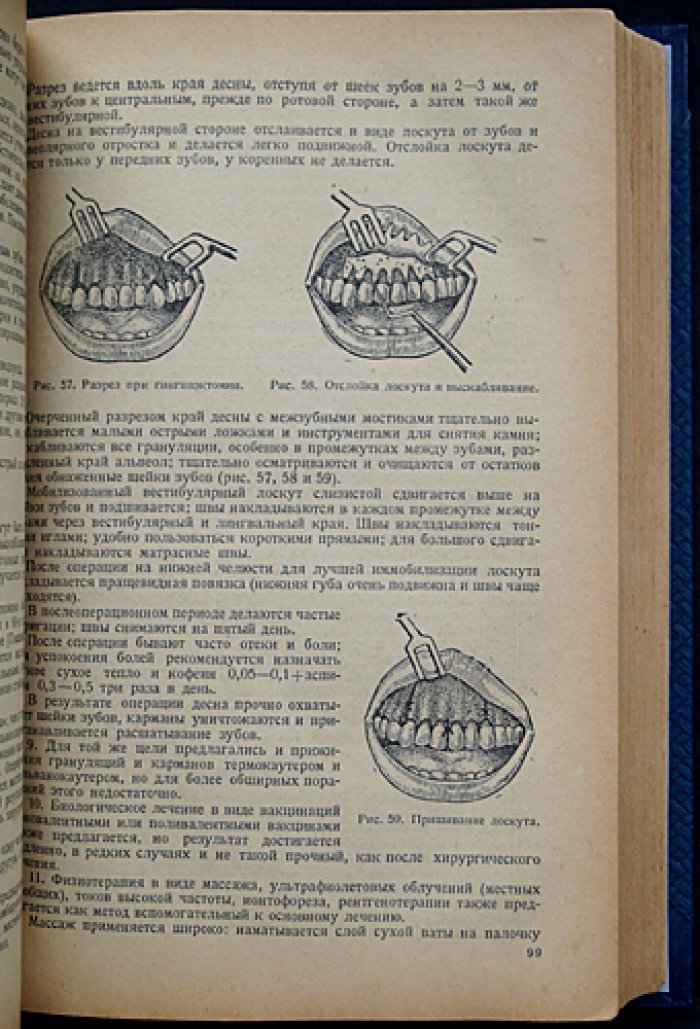 Учебник хирургической стоматологии (1938) — наркоз, экстракция, воспаления, травмы и врожденные патологии лица