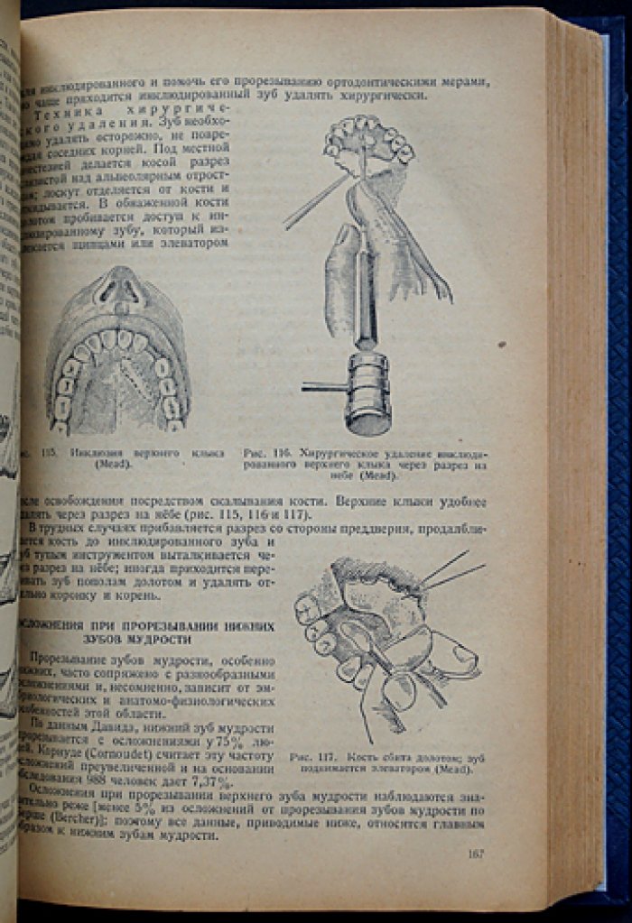 Учебник хирургической стоматологии (1938) — наркоз, экстракция, воспаления, травмы и врожденные патологии лица
