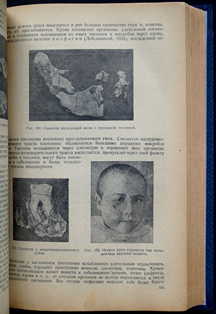 Учебник хирургической стоматологии (1938) — наркоз, экстракция, воспаления, травмы и врожденные патологии лица