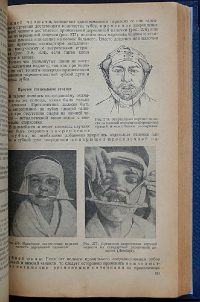 Учебник хирургической стоматологии (1938) — наркоз, экстракция, воспаления, травмы и врожденные патологии лица