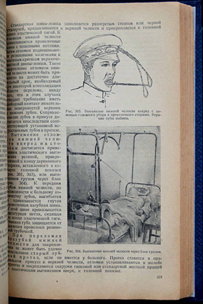 Учебник хирургической стоматологии (1938) — наркоз, экстракция, воспаления, травмы и врожденные патологии лица