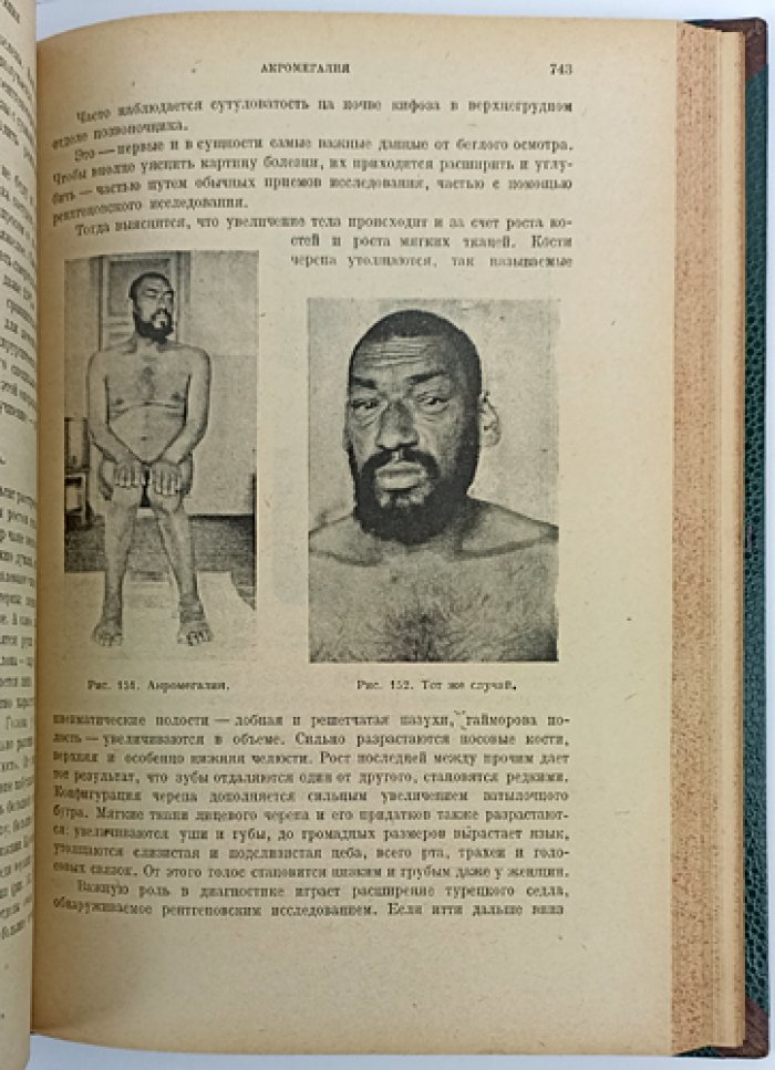 Курс нервных болезней. Классическое руководство по общей и специальной неврологии (1930)