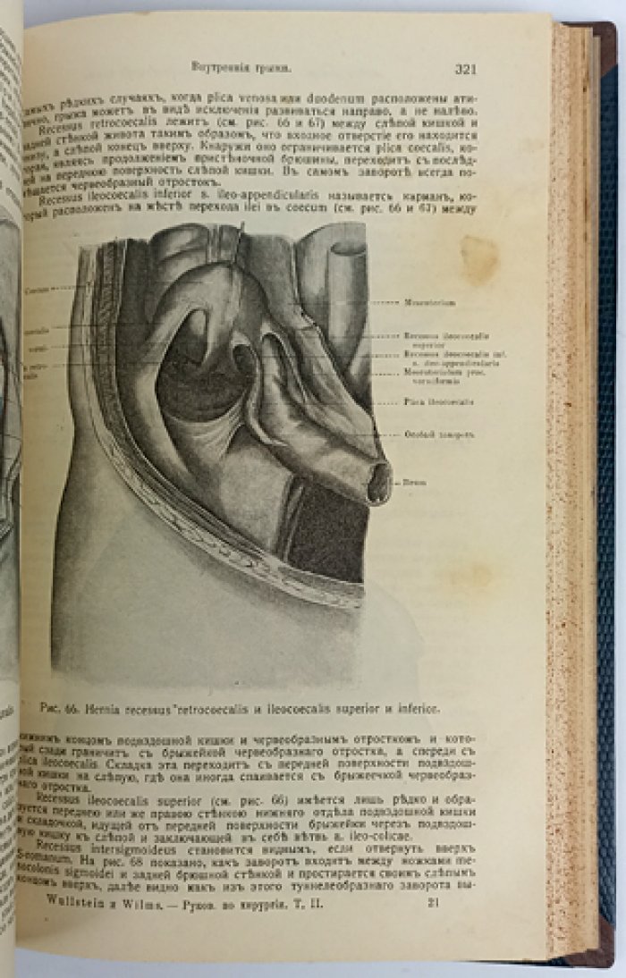 Вюльштейн и Вилмс. Руководство по хирургии. В трех томах (1913)