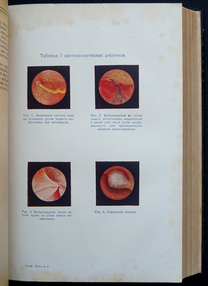 Хольцов Б. Н. Частная урология: собрание в 5 выпусках (Ленинград, 1927–1928)
