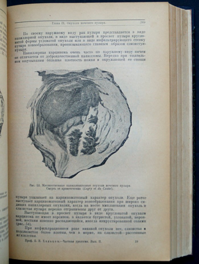 Хольцов Б. Н. Частная урология: собрание в 5 выпусках (Ленинград, 1927–1928)