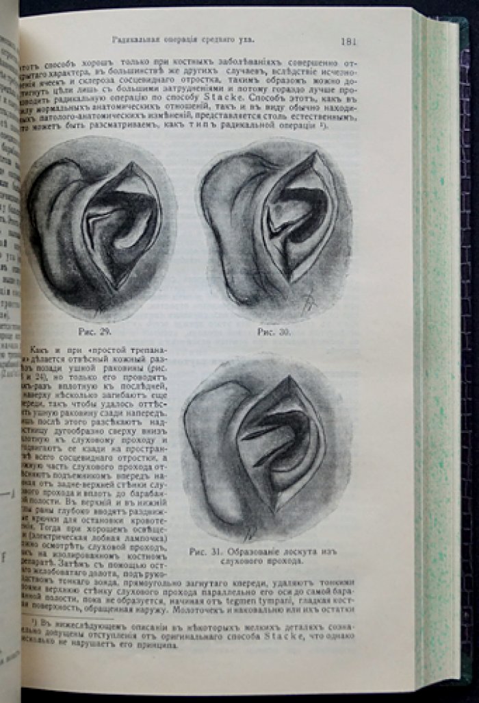 Вулльштейн и Вильмс. Руководство по хирургии. Трёхтомное издание (1913)