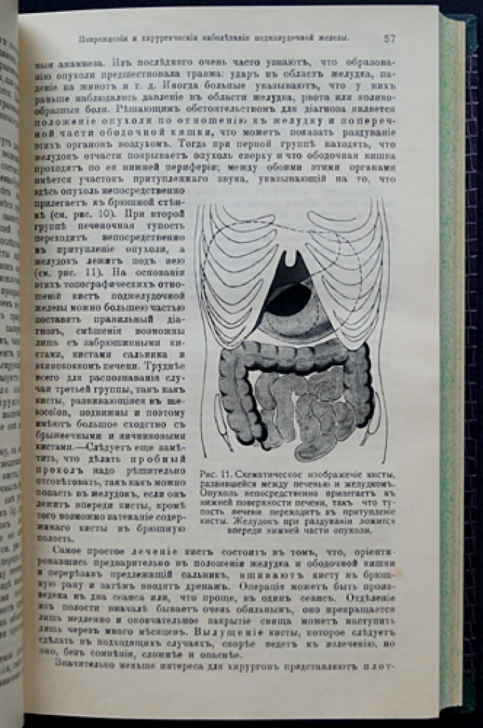 Вулльштейн и Вильмс. Руководство по хирургии. Трёхтомное издание (1913)