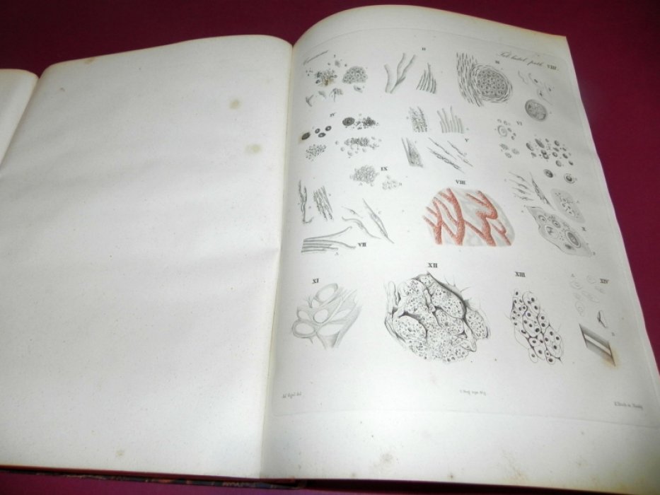 Julii Vogel / Юлий Фогель. Icones Histologiae Pathologicae. Tabulae Histologiam Pathologicam Illustrantes / Иллюстрации по патологической гистологии. Таблицы, поясняющие патологическую гистологию