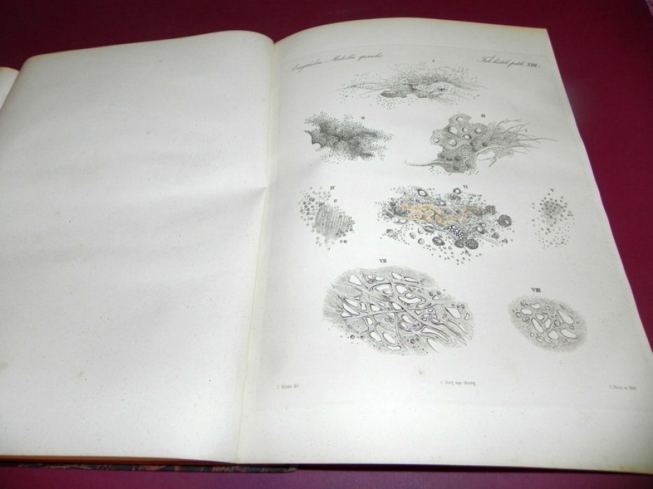 Julii Vogel / Юлий Фогель. Icones Histologiae Pathologicae. Tabulae Histologiam Pathologicam Illustrantes / Иллюстрации по патологической гистологии. Таблицы, поясняющие патологическую гистологию