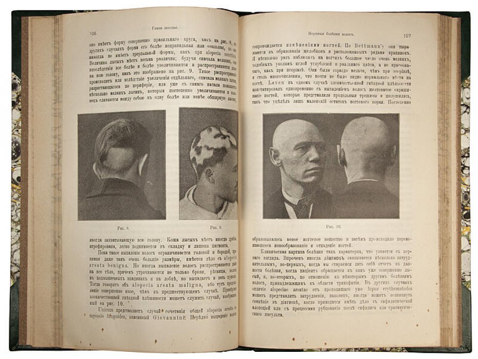 Иозеф М. (Dr. Max Joseph). Руководство к изучению болезней волос (1912) — антикварное издание по дерматологии волос