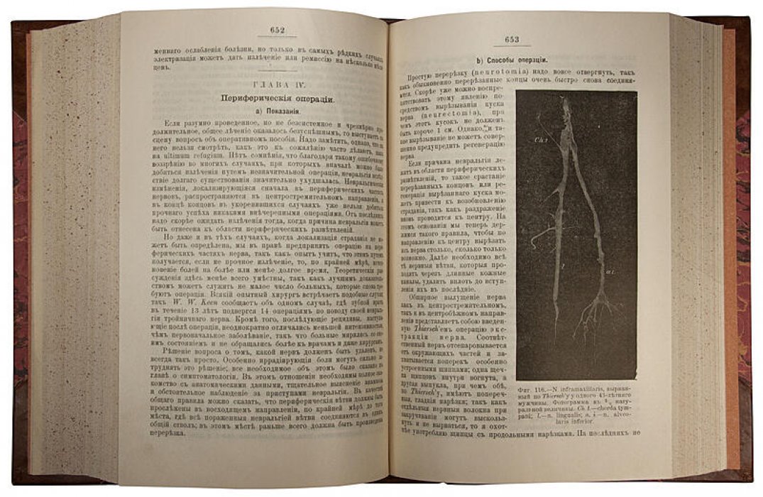 Руководство практической хирургии (антикварное издание, Москва, 1901–1903 гг.) — 4 тома, 6 частей