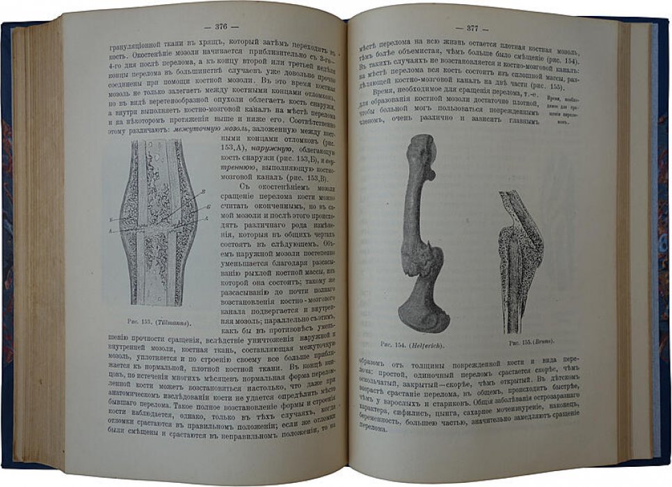 Рейн Ф.А. «Краткое руководство по общей хирургии» (антикварное издание, 1915)